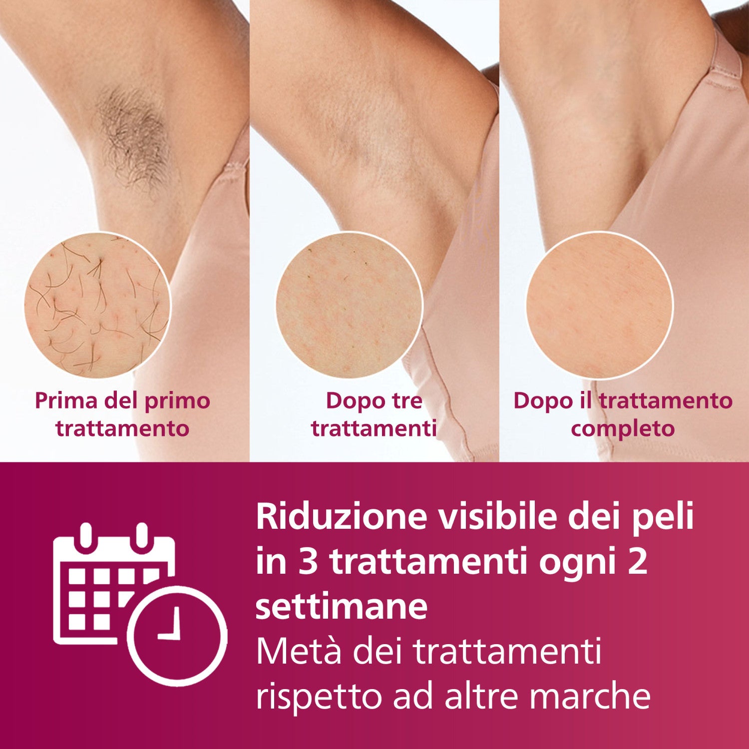 Philips Lumea Advanced Epilatore a Luce Pulsata Lumea bianco BRI920/00 Venduto come Grado A 8720689016780